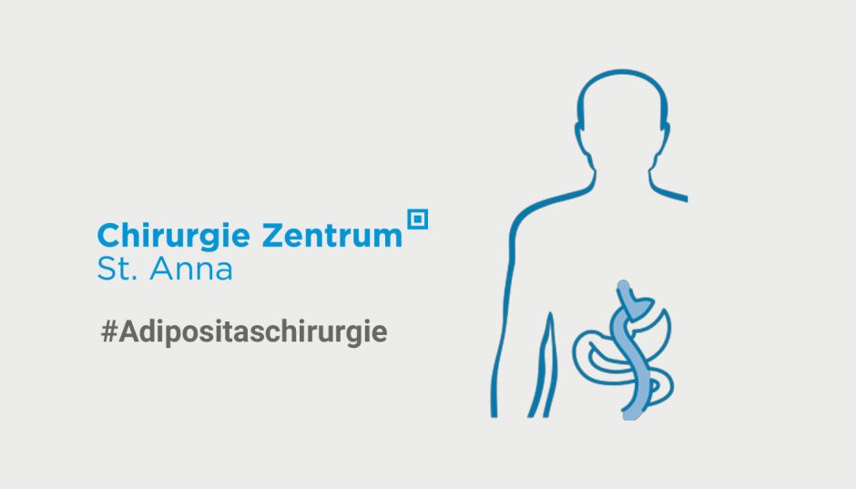 Mythos #2: „Es geht nur um Diät und Bewegung – eine OP ist unnötig.“