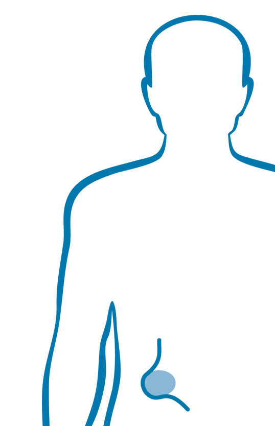 Bauchwand-/Leistenbruchchirurgie